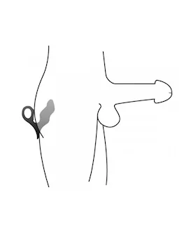 Entrada Silicone Prostate Plug