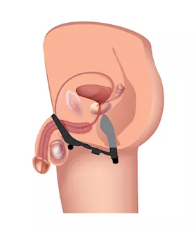 Epic Triple Stim Anal Plug And Cock Ring